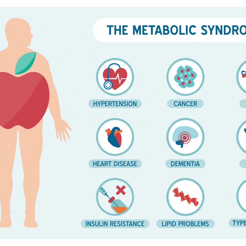 The Metabolic Sundrome