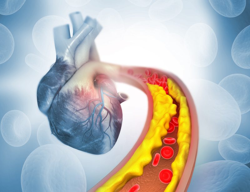 Atherosclerosis And The Biochemistry Behind It