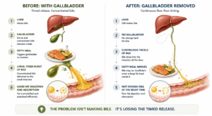 Gallbladder removal before and after